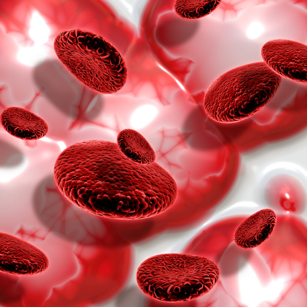 Anemia (Low Hemoglobin)